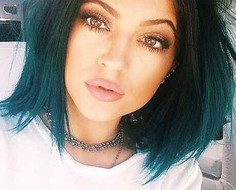 Kylie Jenner’s (@kyliejenner) Lips: Real or Fake?